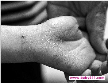 男童做操不认真被锯手腕续:两名老师被开除