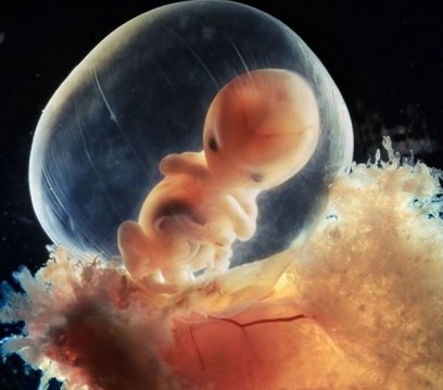 分娩中不得不说的几个问题