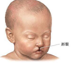 ��������Щ���ñ���������