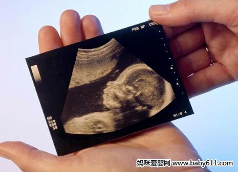 5大因素影响胎儿发育 孕妈如何判断胎儿健康