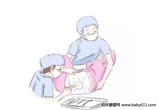 分娩方式不再是一成不变,别再害怕顺产了