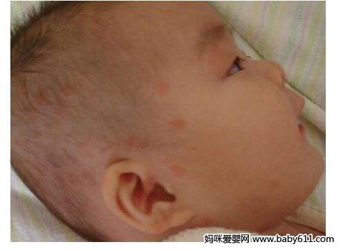 Ӥ��ʪ���ܷ�����ô�죬�⼸�㸸ĸ����֪��