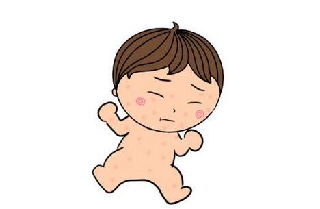 哪些因素会导致婴儿湿疹?