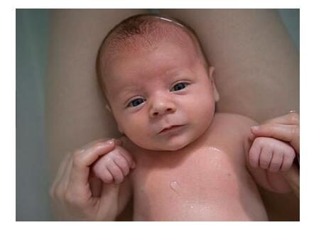 混合喂养宝宝的大便异常情况