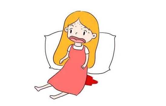 产后出血原因有哪些?