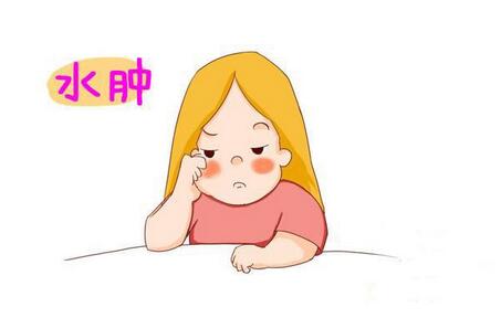 怀孕期间,如何来化解妊娠水肿呢?