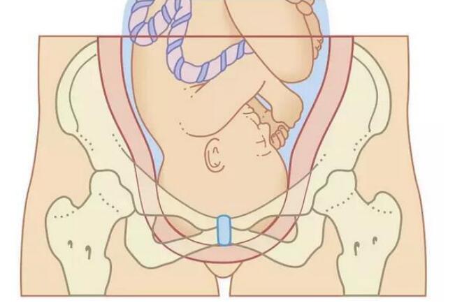 并不是所有妈妈都能顺产的,这几类孕妈只能剖着生