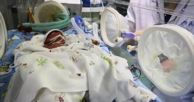 早产儿的6大症状和6个护理关键,越早知道越好……