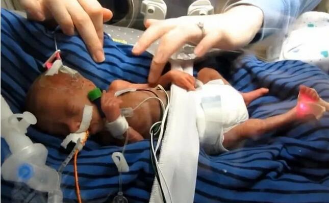 早产儿的6大症状和6个护理关键,越早知道越好……