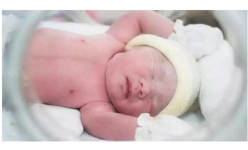 科学有效喂养早产儿 呵护宝宝健康成长