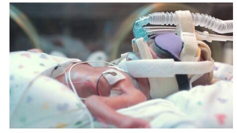 早产儿最容易患的三种疾病