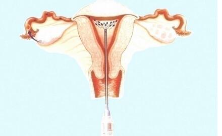 �˹��ھ����Թ�Ӥ����ʲô����