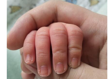 û�뵽����������ָ�ף���Ȼ�ǽ���״������������Ͽ�۲�������