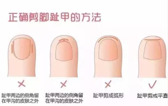 给宝宝剪指甲的正确方法,你学会了吗?