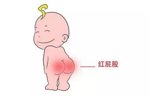 Ԥ��������ƨƨ���־����ҳ���Ҫ��ס��