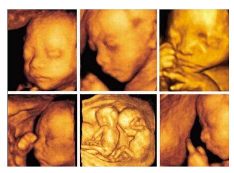 ��ά�ʳ�����ά�ʳ���ʲô����