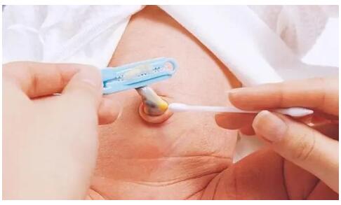 宝宝肚脐护理不当,很容易会出现4种异常情况,新手爸妈要注意