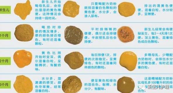 新生儿大便:解读宝宝健康的“晴雨表”